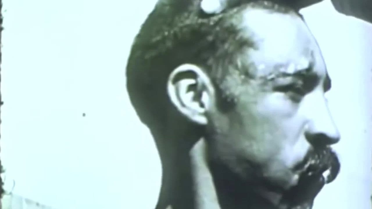 Rabies in a Human Patient